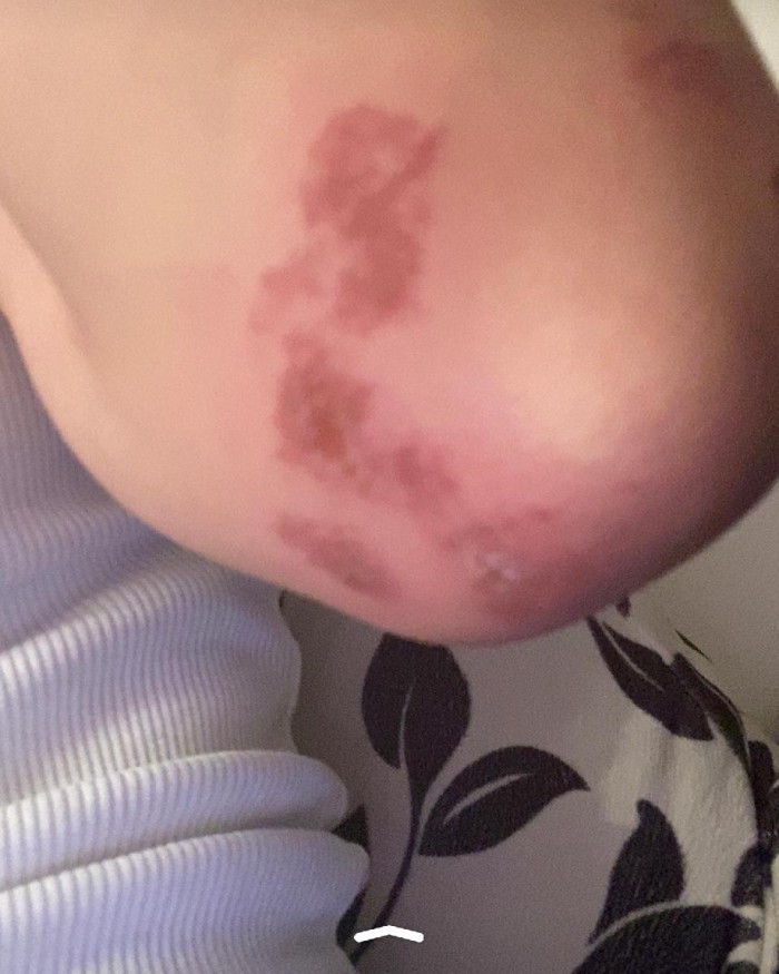 Bloger ərinin voleybolçu sevgilisi tərəfindən döyülüb - İDDİA  (FOTOLAR)